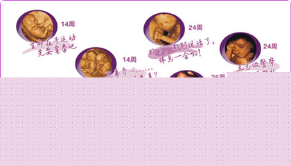 四维彩超在怀孕后什么时间做好?